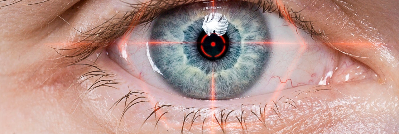 Laserung des Auges